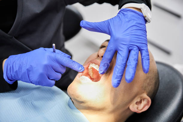 Best Emergency Root Canal Treatment in Peekskill, NY